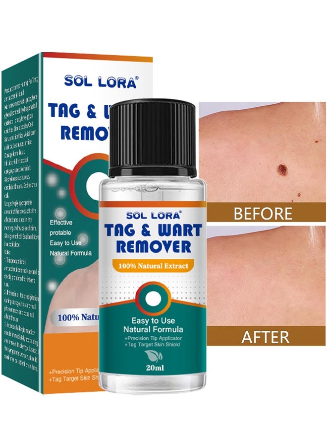 SOL LORA Natural & Safe Wart And Mole Remover Liquid, Wart Remover Liquid, Salicylic Acid Fast-Acting Formula For Plantar Warts, Skin Tags, Corns & Callus Removal, Pain-Free Scar-Free Treatment, Toes & Foot Care For Men & Women, 20ml - Image 1